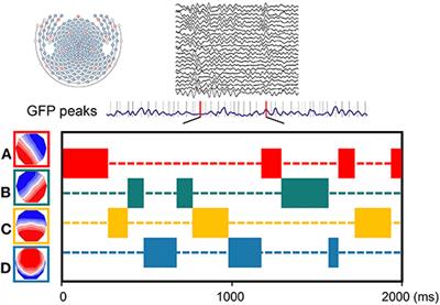 Intrinsic Brain Activity in Temporal Lobe Epilepsy With and Without Depression: Insights From EEG Microstates